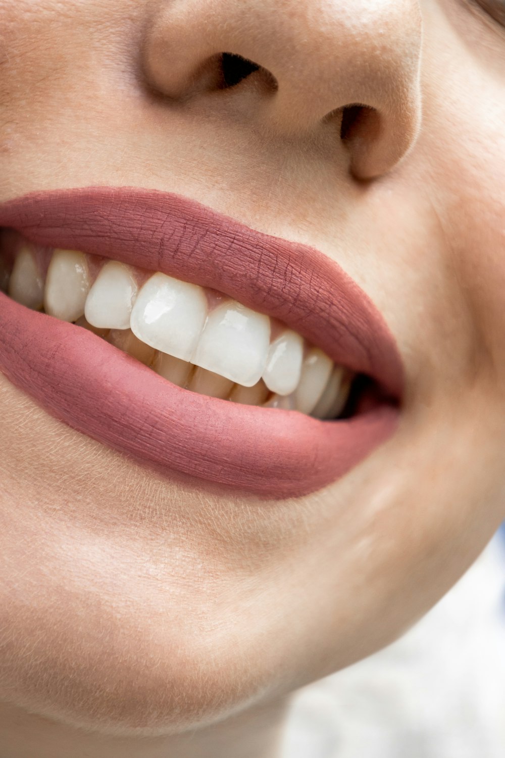 Close-up of a natural, even smile after porcelain veneers